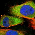 ADSL Antibody in Immunocytochemistry (ICC/IF)