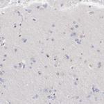 ADSL Antibody in Immunohistochemistry (Paraffin) (IHC (P))