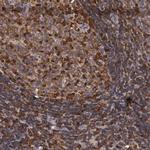 ADSL Antibody in Immunohistochemistry (Paraffin) (IHC (P))