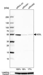 ADSL Antibody