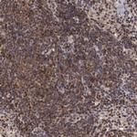 ADSL Antibody in Immunohistochemistry (IHC)