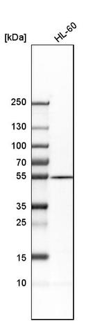 ADSL Antibody in Western Blot (WB)