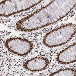 PHF14 Antibody in Immunohistochemistry (Paraffin) (IHC (P))