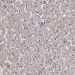 CRIM1 Antibody in Immunohistochemistry (IHC)