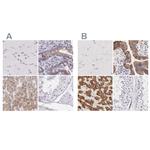 OTC Antibody in Immunohistochemistry (IHC)