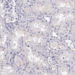 OTC Antibody in Immunohistochemistry (IHC)