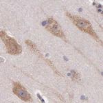 NSDHL Antibody in Immunohistochemistry (IHC)