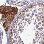 NSDHL Antibody in Immunohistochemistry (IHC)