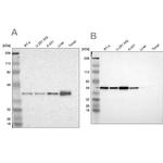 NSDHL Antibody in Western Blot (WB)