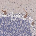 ABHD4 Antibody in Immunohistochemistry (Paraffin) (IHC (P))