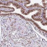 Emerin Antibody in Immunohistochemistry (Paraffin) (IHC (P))