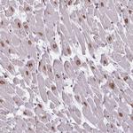 Emerin Antibody in Immunohistochemistry (Paraffin) (IHC (P))