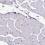 Emerin Antibody in Immunohistochemistry (Paraffin) (IHC (P))