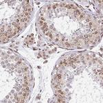 Emerin Antibody in Immunohistochemistry (Paraffin) (IHC (P))