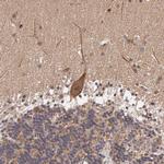 IGBP1 Antibody in Immunohistochemistry (Paraffin) (IHC (P))