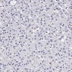 IGBP1 Antibody in Immunohistochemistry (Paraffin) (IHC (P))