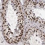 PABPN1 Antibody in Immunohistochemistry (IHC)