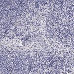 PIRIN Antibody in Immunohistochemistry (IHC)