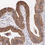 PIRIN Antibody in Immunohistochemistry (IHC)