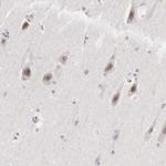 MNAT1 Antibody in Immunohistochemistry (Paraffin) (IHC (P))