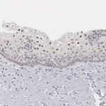 MNAT1 Antibody in Immunohistochemistry (Paraffin) (IHC (P))