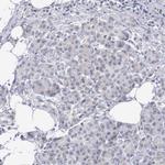 MNAT1 Antibody in Immunohistochemistry (Paraffin) (IHC (P))