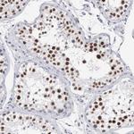 MNAT1 Antibody in Immunohistochemistry (Paraffin) (IHC (P))