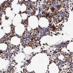 Serglycin Antibody in Immunohistochemistry (Paraffin) (IHC (P))