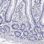 Serglycin Antibody in Immunohistochemistry (Paraffin) (IHC (P))