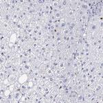 Serglycin Antibody in Immunohistochemistry (IHC)