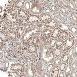 ACOT4 Antibody in Immunohistochemistry (IHC)