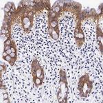 UPRT Antibody in Immunohistochemistry (Paraffin) (IHC (P))