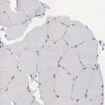 NPC2 Antibody in Immunohistochemistry (IHC)