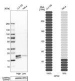 NPC2 Antibody in Western Blot (WB)