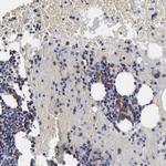 TXLNG Antibody in Immunohistochemistry (Paraffin) (IHC (P))