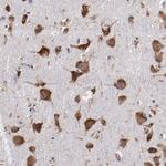 RPS4Y1 Antibody in Immunohistochemistry (Paraffin) (IHC (P))