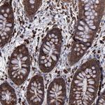 RPS4Y1 Antibody in Immunohistochemistry (Paraffin) (IHC (P))