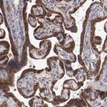 RPS4Y1 Antibody in Immunohistochemistry (Paraffin) (IHC (P))