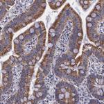 SYNJ2BP Antibody in Immunohistochemistry (Paraffin) (IHC (P))