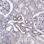 SYNJ2BP Antibody in Immunohistochemistry (Paraffin) (IHC (P))