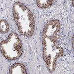 SYNJ2BP Antibody in Immunohistochemistry (Paraffin) (IHC (P))