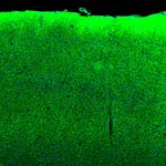 SYNJ2BP Antibody in Immunohistochemistry (Paraffin) (IHC (P))