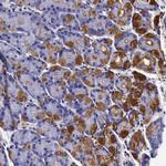 CCDC22 Antibody in Immunohistochemistry (Paraffin) (IHC (P))