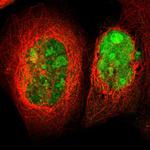 TRMT5 Antibody in Immunocytochemistry (ICC/IF)