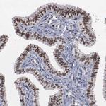 TRMT5 Antibody in Immunohistochemistry (Paraffin) (IHC (P))