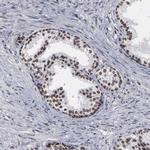 TRMT5 Antibody in Immunohistochemistry (Paraffin) (IHC (P))