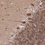 ARMX3 Antibody in Immunohistochemistry (Paraffin) (IHC (P))