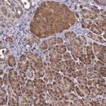 ARMX3 Antibody in Immunohistochemistry (Paraffin) (IHC (P))