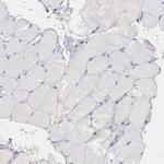 GOLGA5 Antibody in Immunohistochemistry (Paraffin) (IHC (P))