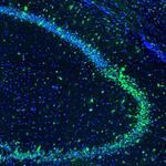 GOLGA5 Antibody in Immunohistochemistry (Paraffin) (IHC (P))